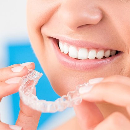 Invisalign Aligners